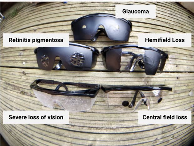 5 pairs of simulation glasses for Glaucoma, Retinitis pigmentosa, hemifield loss, central field loss, and severe loss of vision